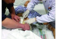 盛开的玫瑰依然精彩: 造口人士有“口”不再难开-雉水网