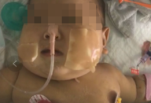 六月大男婴患重病   外婆捐肝救孙为其续命-雉水网