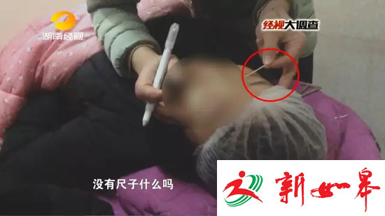 刘老师用牙签测量所需双眼皮宽度