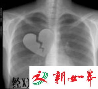 女子赴美嫁网友遭毒打强暴 她还发现一个更大谎言