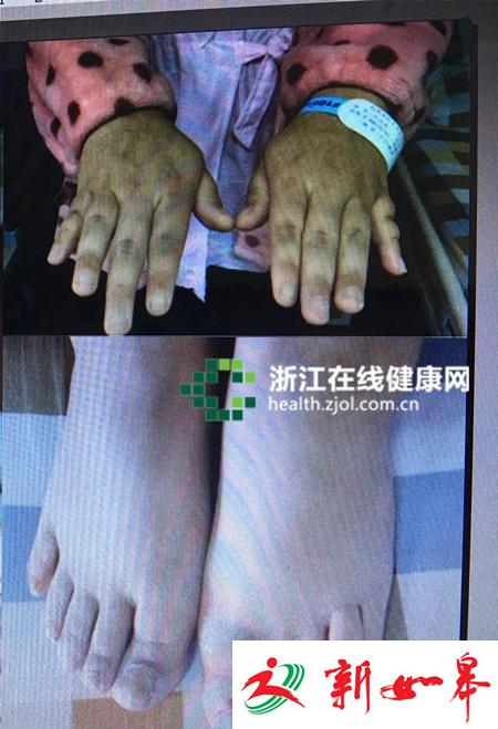 女子22岁从没来过