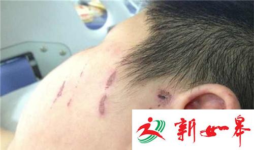 西安一14岁男孩拐走9岁男童:用板凳砸 用烟头烫