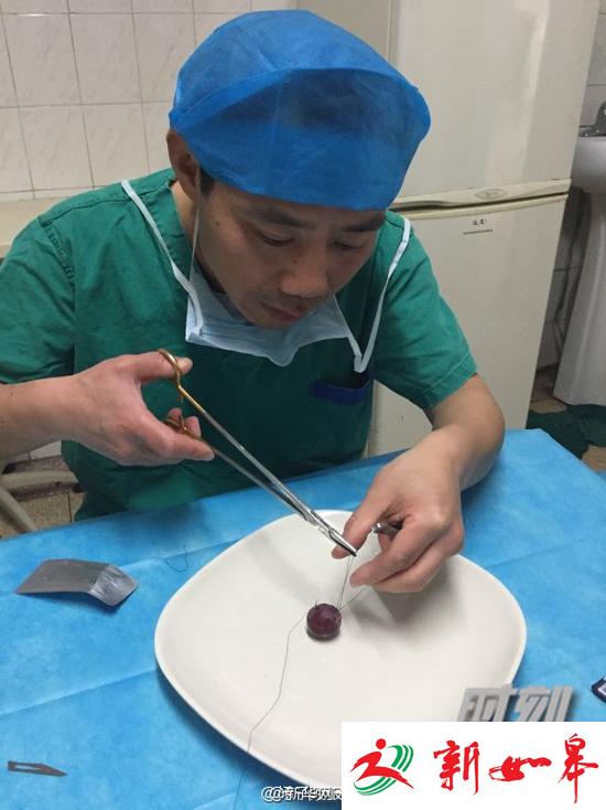 外科医生用棉签吃饭，只为锻炼手术技艺