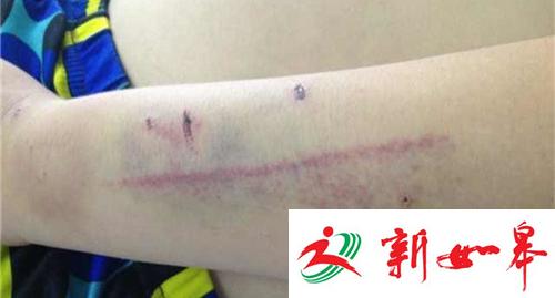 西安一14岁男孩拐走9岁男童:用板凳砸 用烟头烫