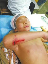 景区本无猴引入酿大灾 称为治猴患避孕药都试过