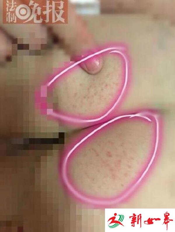 谁不听话就扎谁？吉林4名幼教因针刺儿童被判刑