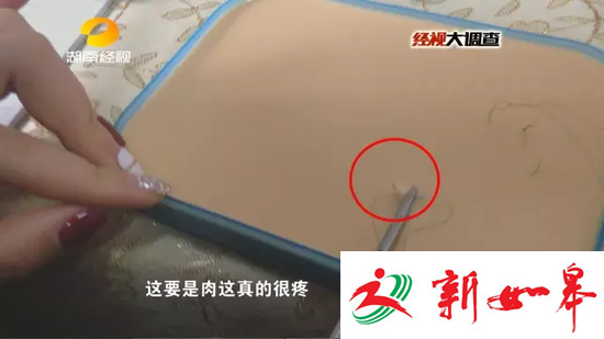 刘老师让学员在练习皮上练习双眼皮手术