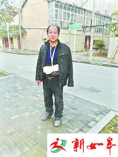 民工为救陌生人紧抱70公斤倾倒路灯 手指被勒断 