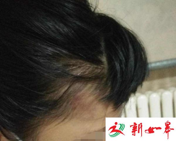 两女生寝室遭殴打 打人同学晒图：已对警车免疫