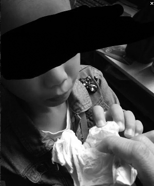 女童被打，鼻子出血 网络图片