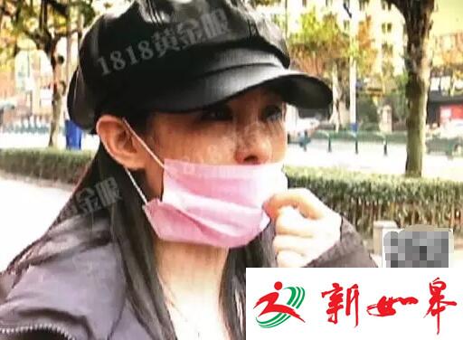 姑娘为整容打掉肚里的孩子 鼻孔被整成成