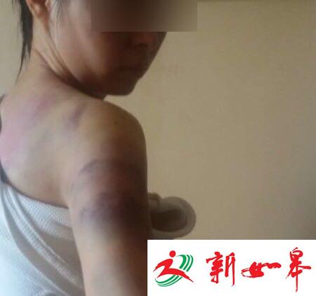 女医生服毒后遭前夫殴打毒发身亡 前夫获刑6月