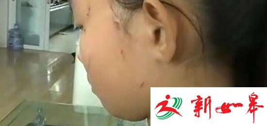 培训学校老师借打气筒起纠纷打伤12岁女生 被辞退