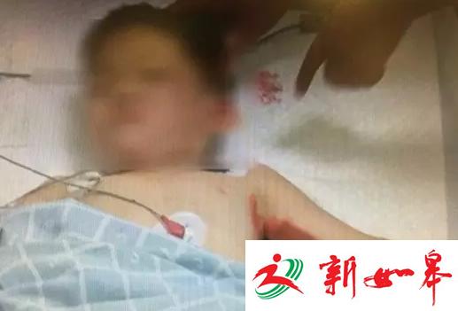 深圳停车场3名小孩遭碾压 目击者称女司机在看手机
