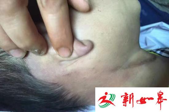 厦门4岁男童幼儿园内死亡 园方称