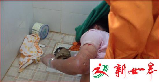 男子如厕时手机掉落厕所管道 打捞时手被卡住