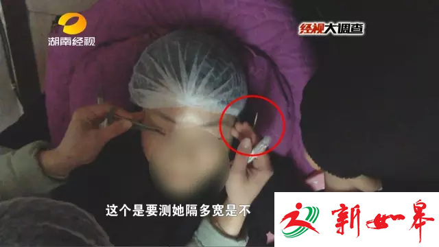 揭非法微整形:用牙签量顾客眼皮 厕所门口做手术