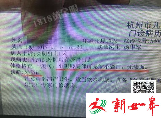 女婴生活馆洗澡后下体撕裂 监控全程被人遮挡