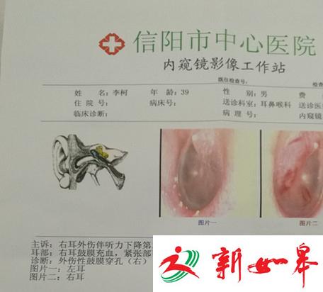 河南一高中生手机被收 官员父亲疑酒后打伤老师